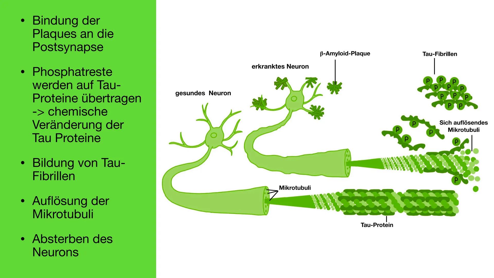 Neuronale Erkrankung am
Beispiel Alzheimer
Störung des Hirnstoffwechsels Inhalt
●
• Demenz und Alzheimer
• Symptome von Alzheimer
●
• Neuron