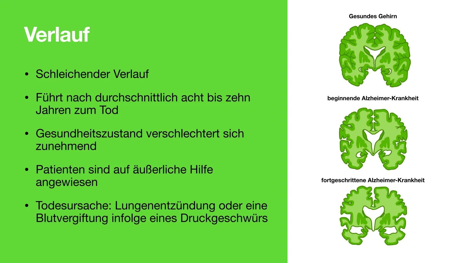 Neuronale Erkrankung am
Beispiel Alzheimer
Störung des Hirnstoffwechsels Inhalt
●
• Demenz und Alzheimer
• Symptome von Alzheimer
●
• Neuron