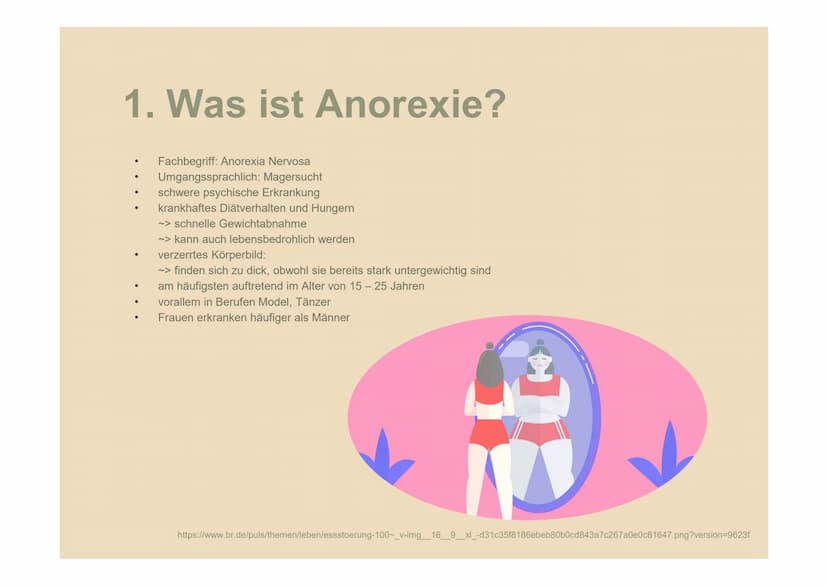 Anorexia
Nervosa
Magersucht Gliederung
1
Was ist Anorexie?
2
Ursachen
3
Symptome
4
Krankheitsverlauf
5
Folgen
6
Prognose
7
Wie gehe ich
dami