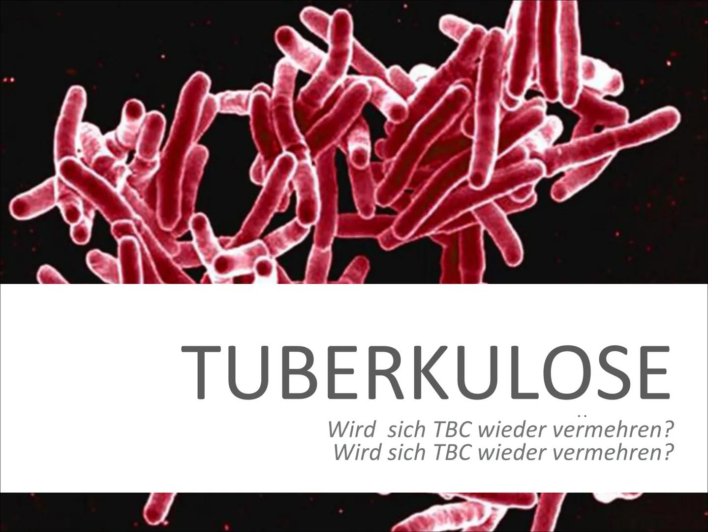 # TUBERKULOSE

Wird sich TBC wieder vermehren? Wird sich TBC wieder vermehren? # INHALT

- Was ist das?
- Geschichte
- Verlauf der Erkrankun