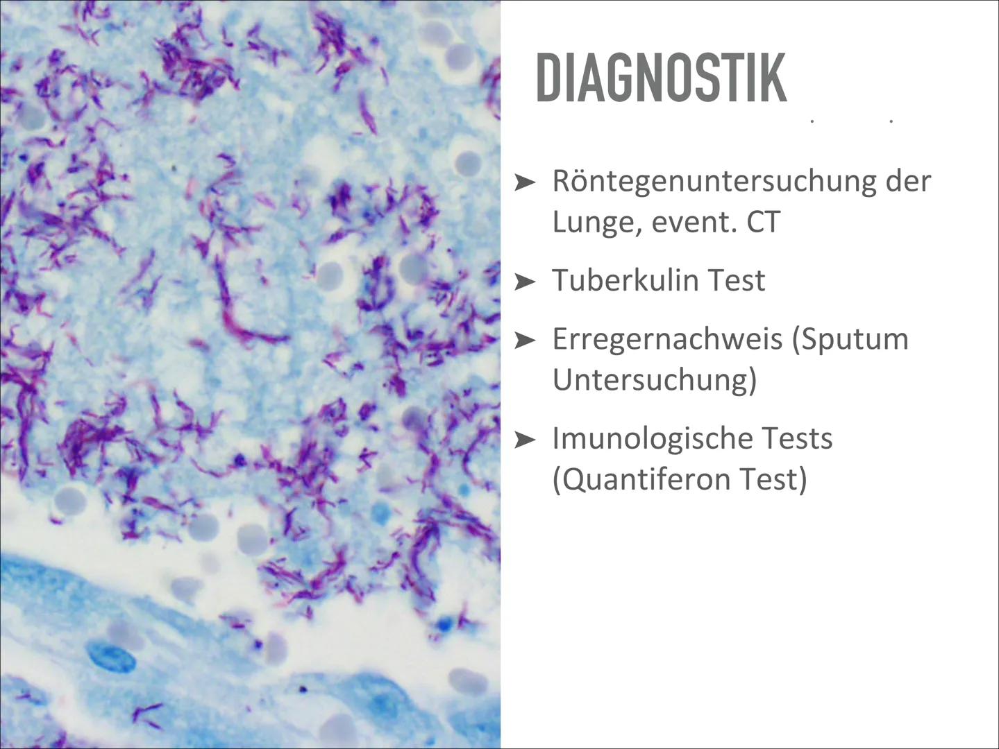 # TUBERKULOSE

Wird sich TBC wieder vermehren? Wird sich TBC wieder vermehren? # INHALT

- Was ist das?
- Geschichte
- Verlauf der Erkrankun