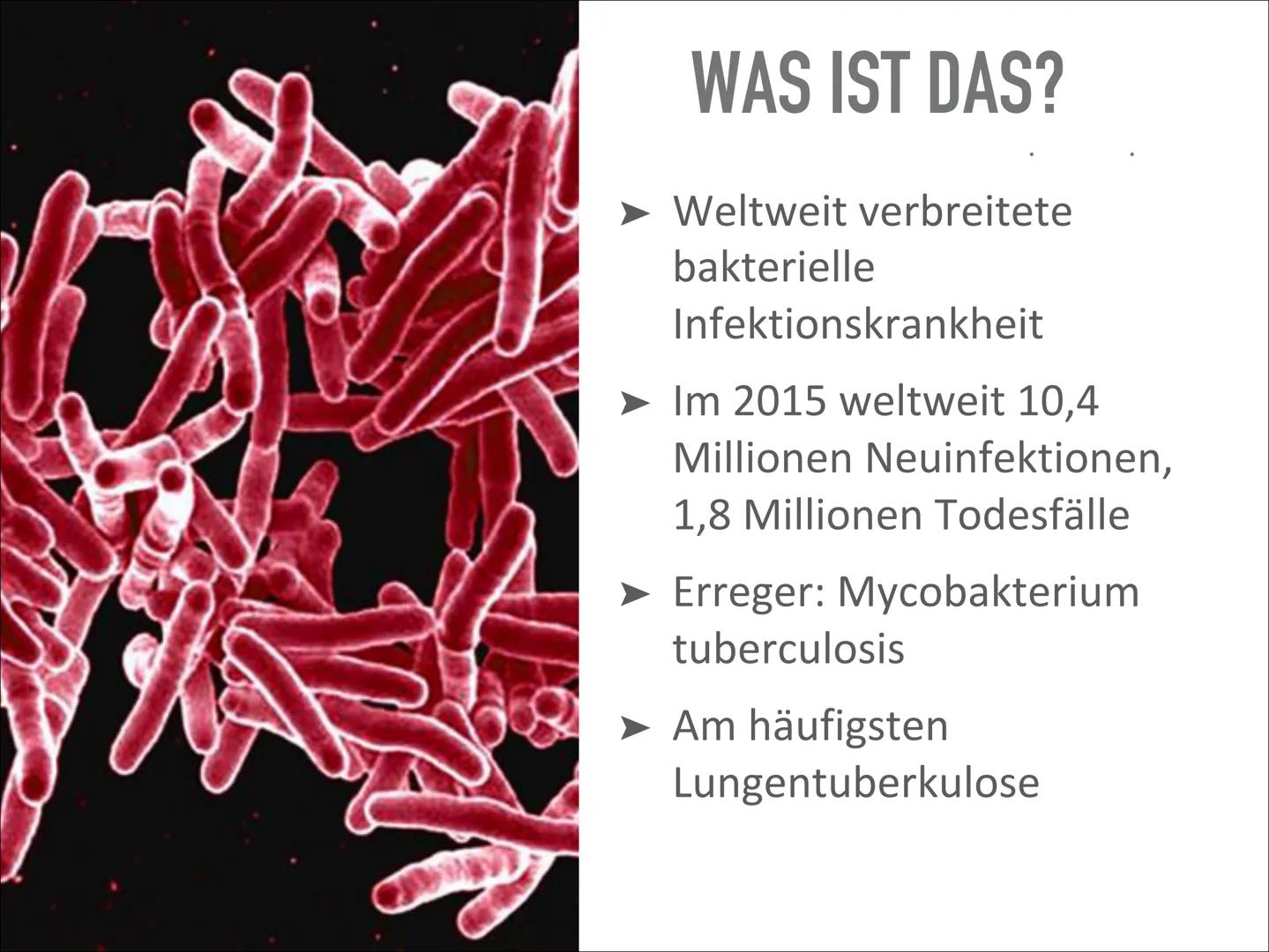 # TUBERKULOSE

Wird sich TBC wieder vermehren? Wird sich TBC wieder vermehren? # INHALT

- Was ist das?
- Geschichte
- Verlauf der Erkrankun
