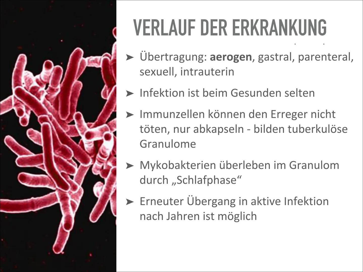 # TUBERKULOSE

Wird sich TBC wieder vermehren? Wird sich TBC wieder vermehren? # INHALT

- Was ist das?
- Geschichte
- Verlauf der Erkrankun
