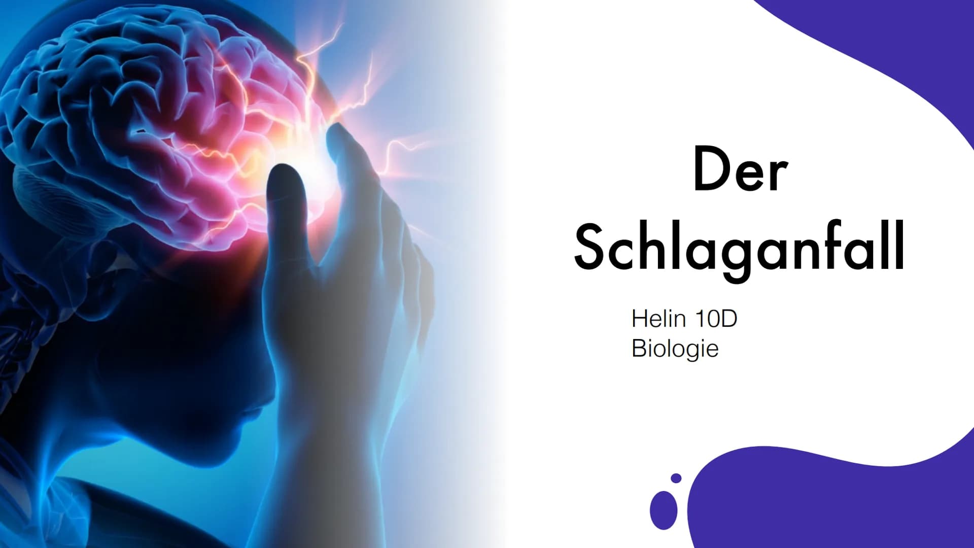 Der
Schlaganfall
Helin 10D
Biologie Gliederung
1. Was ist der Schlaganfall eigentlich?
2. Auftreten
3. Risikofaktoren
4. Ursachen
5. Symptom
