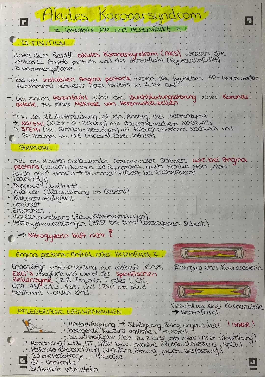 G
Akutes Koronarsyndrom
= instabile AP und Herzinfarkt 21
DEFINITION::
Unter dem Begriff akutes Koronassyndrom (AKS) werden die
instabile. A