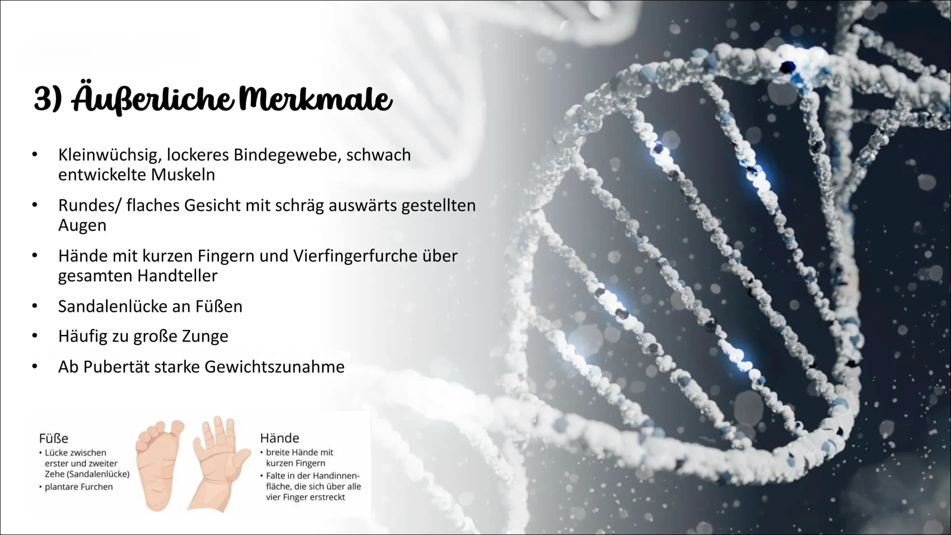 Genetik
Die Erbkrankheit „Trisomie 21"
Weronika Konopka 10a- Biologie Gliederung
1. Einführung
2. Erklärung
3. äußerliche Merkmale
3.1. gesu