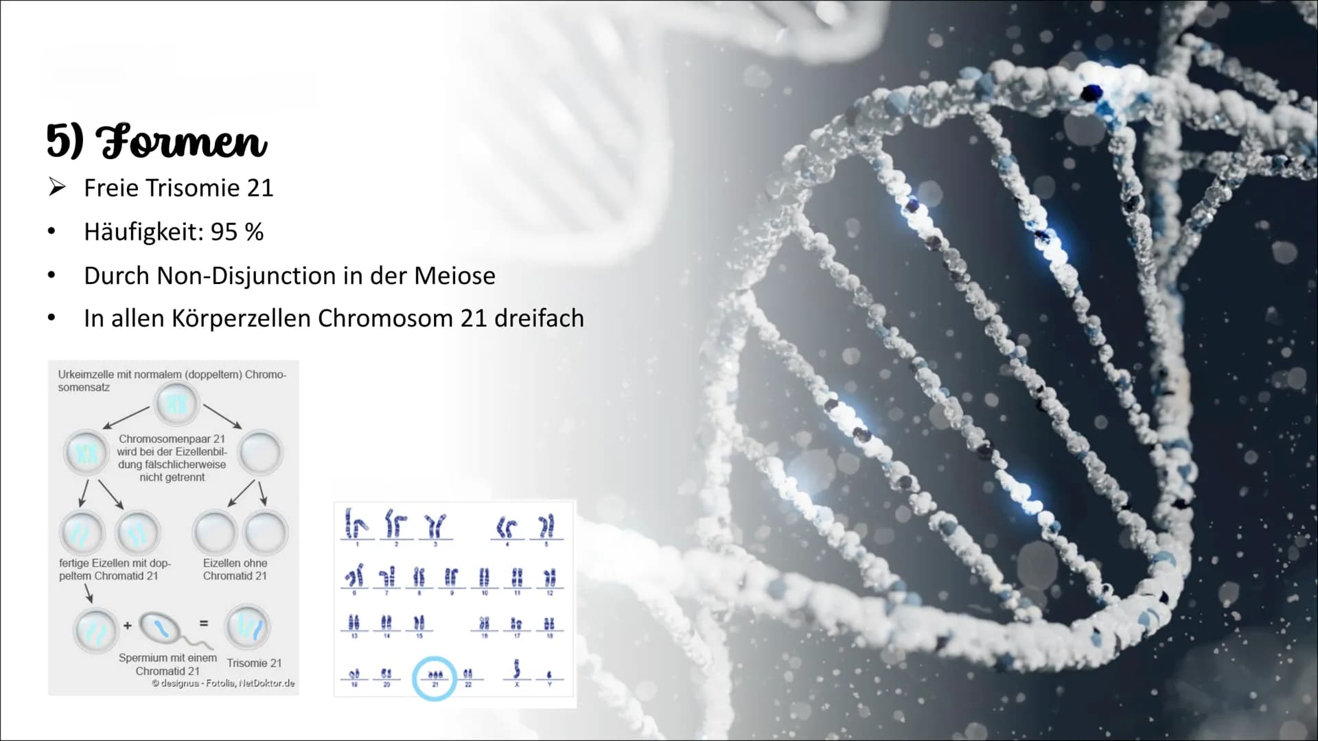 Genetik
Die Erbkrankheit „Trisomie 21"
Weronika Konopka 10a- Biologie Gliederung
1. Einführung
2. Erklärung
3. äußerliche Merkmale
3.1. gesu