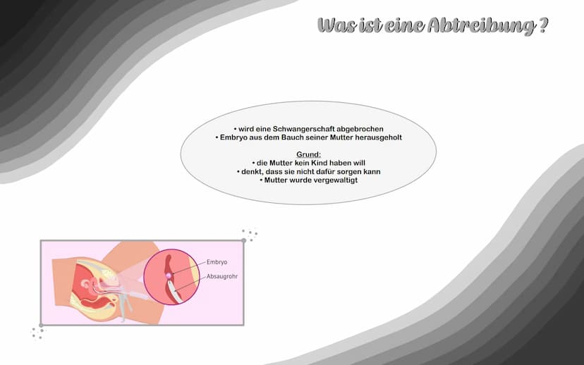 Abtreibung •
Sollte man Abtreiben oder nicht und was sagt die Kirche dazu? 1. Was ist eine Abtreibung?
2. Rechtliche Grundlagen
Themenüberbl