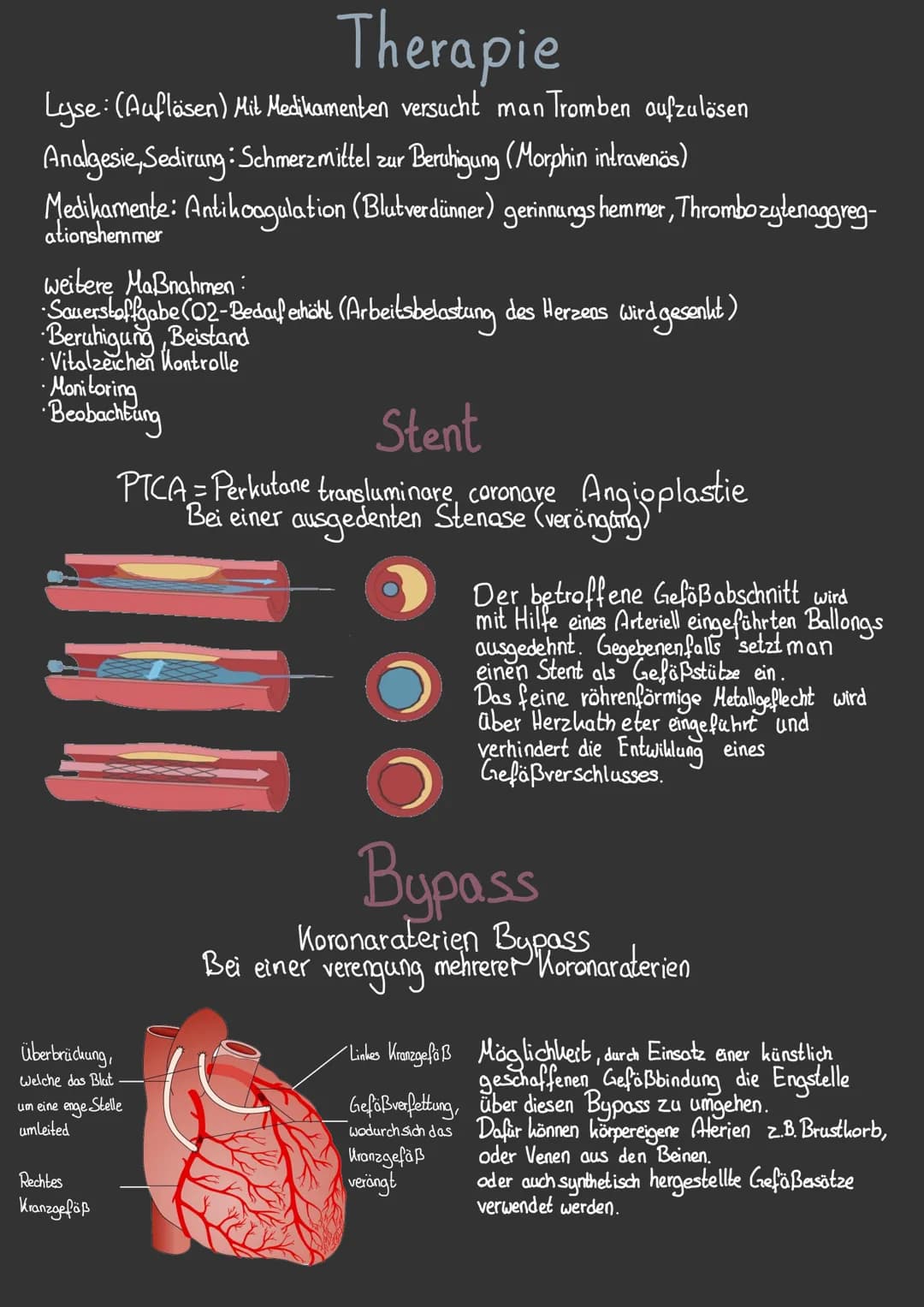 obere
Holvene
Lungen Schlagader-
Trikuspidalkluppe.
Pulmonalklappe
untere Holvene
Rechter Ventrikel
Lungen
Aterie
●
Lungen
Vene
Das Herz
Aor