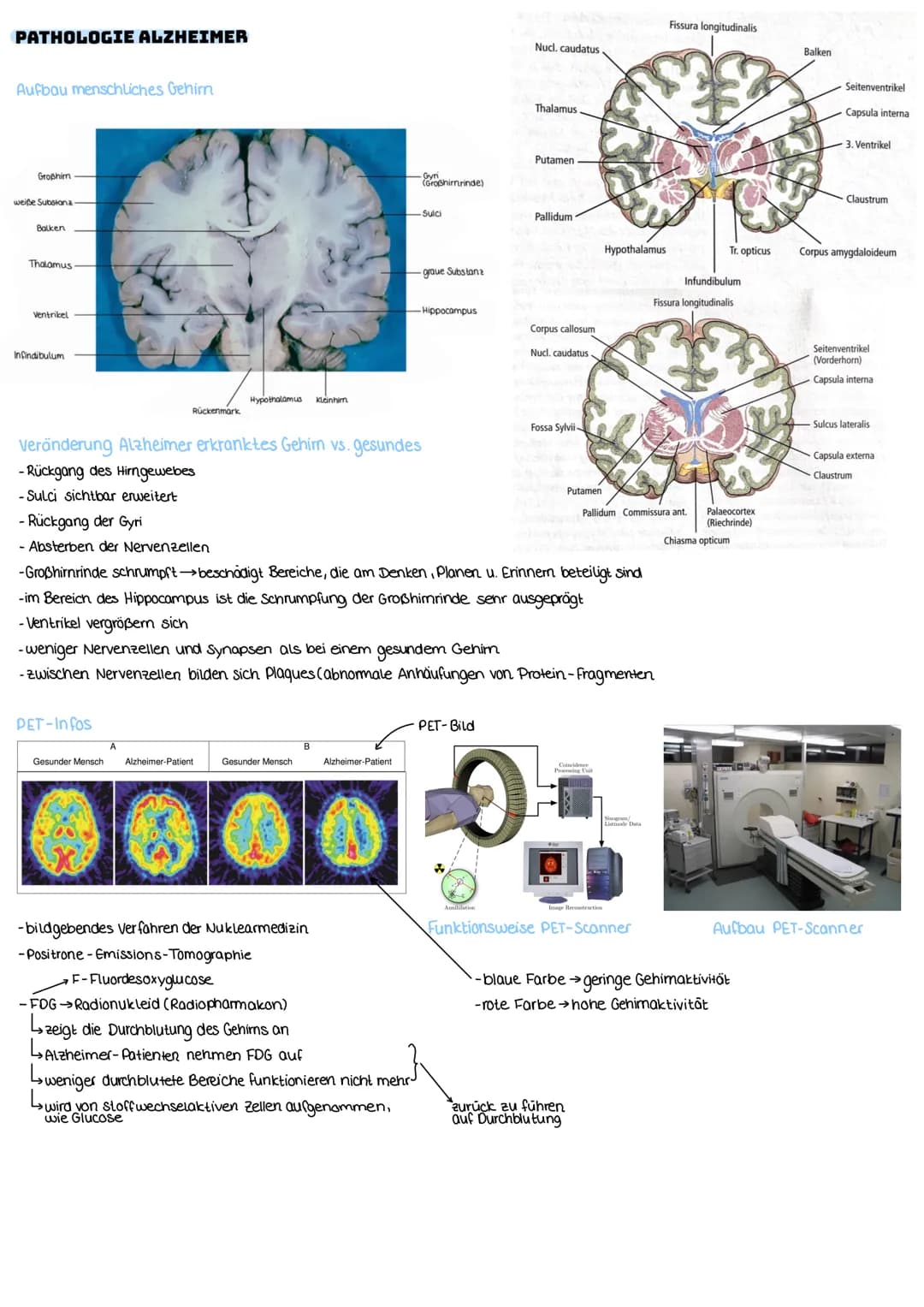 NEURODEGENERATIVE ERKRANKUNGEN
ALZHEIMER-ALLGEMEINES
Allgemeines
- häufigste Form der Demenz
- Absterben der Nervenzelle→ Die Himrinde wird 