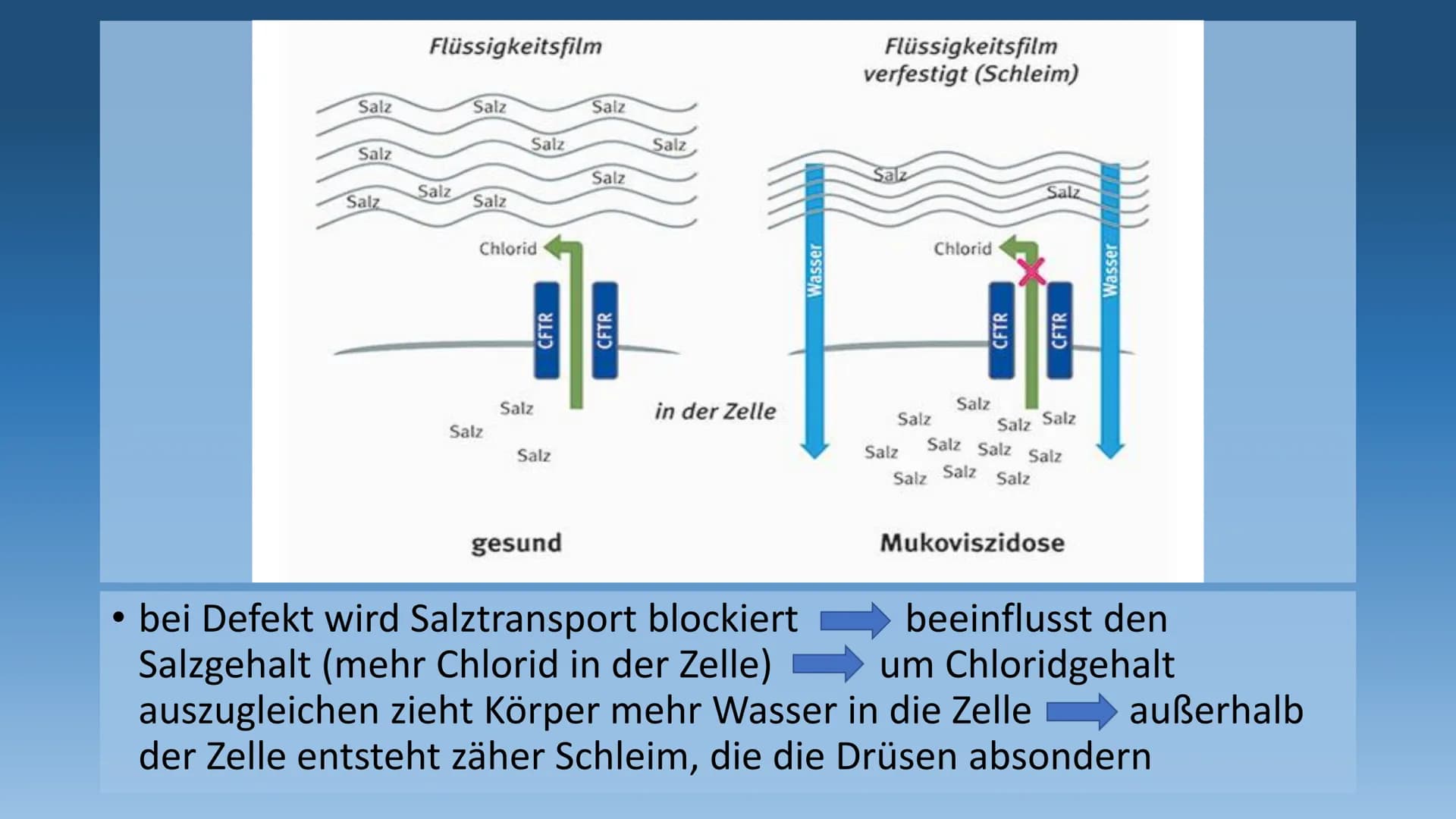 DIE MUKOVISZIDOSE
- auch cystische Fibrose genannt - 1.
Definition
2. Häufigkeit
3. Ursachen
3.1 Folgen
4. Symptome
GLIEDERUNG
5. Diagnose
6