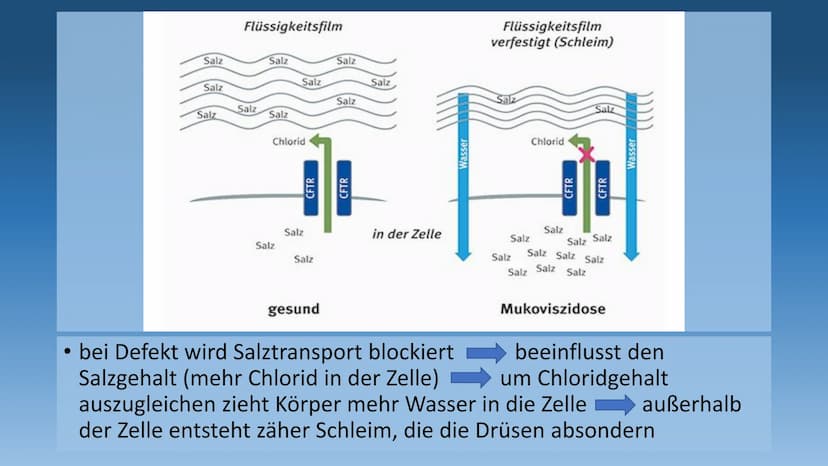 DIE MUKOVISZIDOSE
- auch cystische Fibrose genannt - 1.
Definition
2. Häufigkeit
3. Ursachen
3.1 Folgen
4. Symptome
GLIEDERUNG
5. Diagnose
6