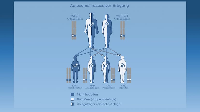 DIE MUKOVISZIDOSE
- auch cystische Fibrose genannt - 1.
Definition
2. Häufigkeit
3. Ursachen
3.1 Folgen
4. Symptome
GLIEDERUNG
5. Diagnose
6