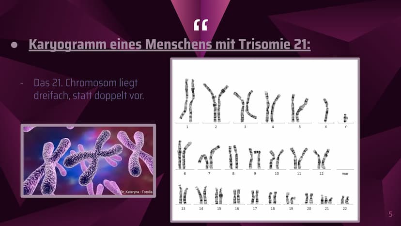 Das Down-Syndrom
(Trisomie 21) Inhaltsverzeichnis
1. Welches Menschenbild hat man?
2. Allgemeine Informationen
3. Formen und Entstehung des 