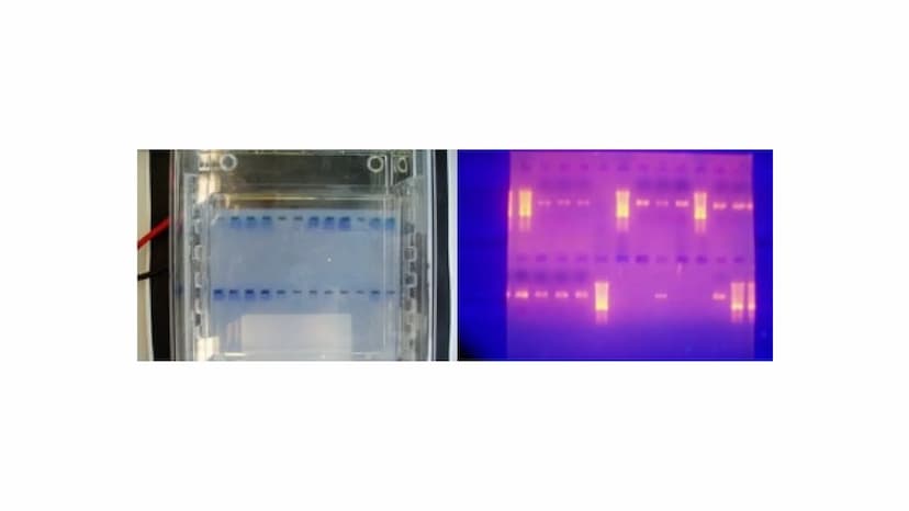 Gelelektrophorese
Q1- Biologiegrundkurs Übersicht der Präsentation
Definition
Verwendung
Material
Ablauf
Auswertung
Quellen Frage
Was denkt 