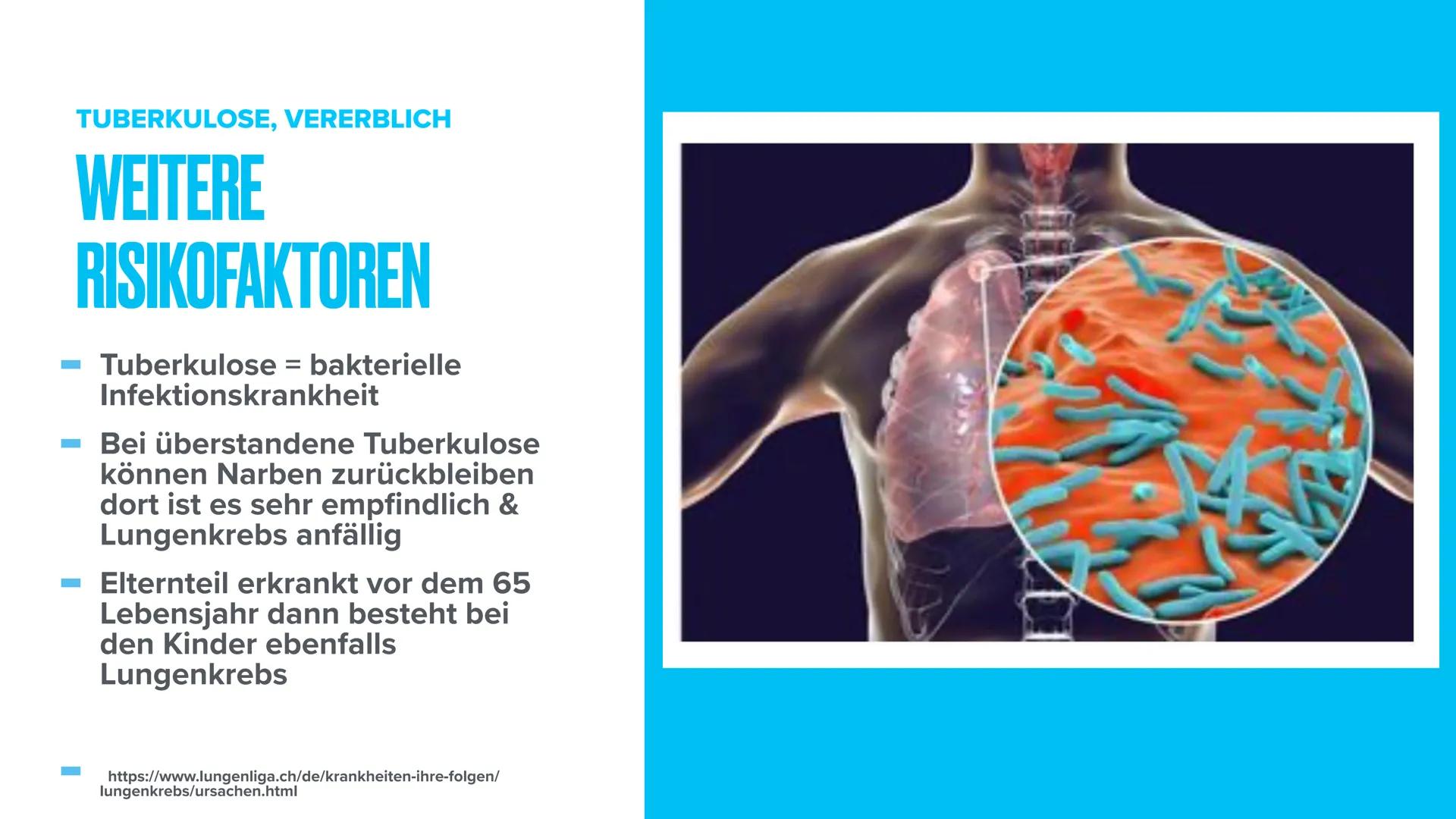 LUNGENKREBS
Biologie THEMEN
- Was ist Lungenkrebs?
Erkrankte & verstorbene in Deutschland
- Arten von Lungenkrebs
- Stadien von Lungenkrebs
