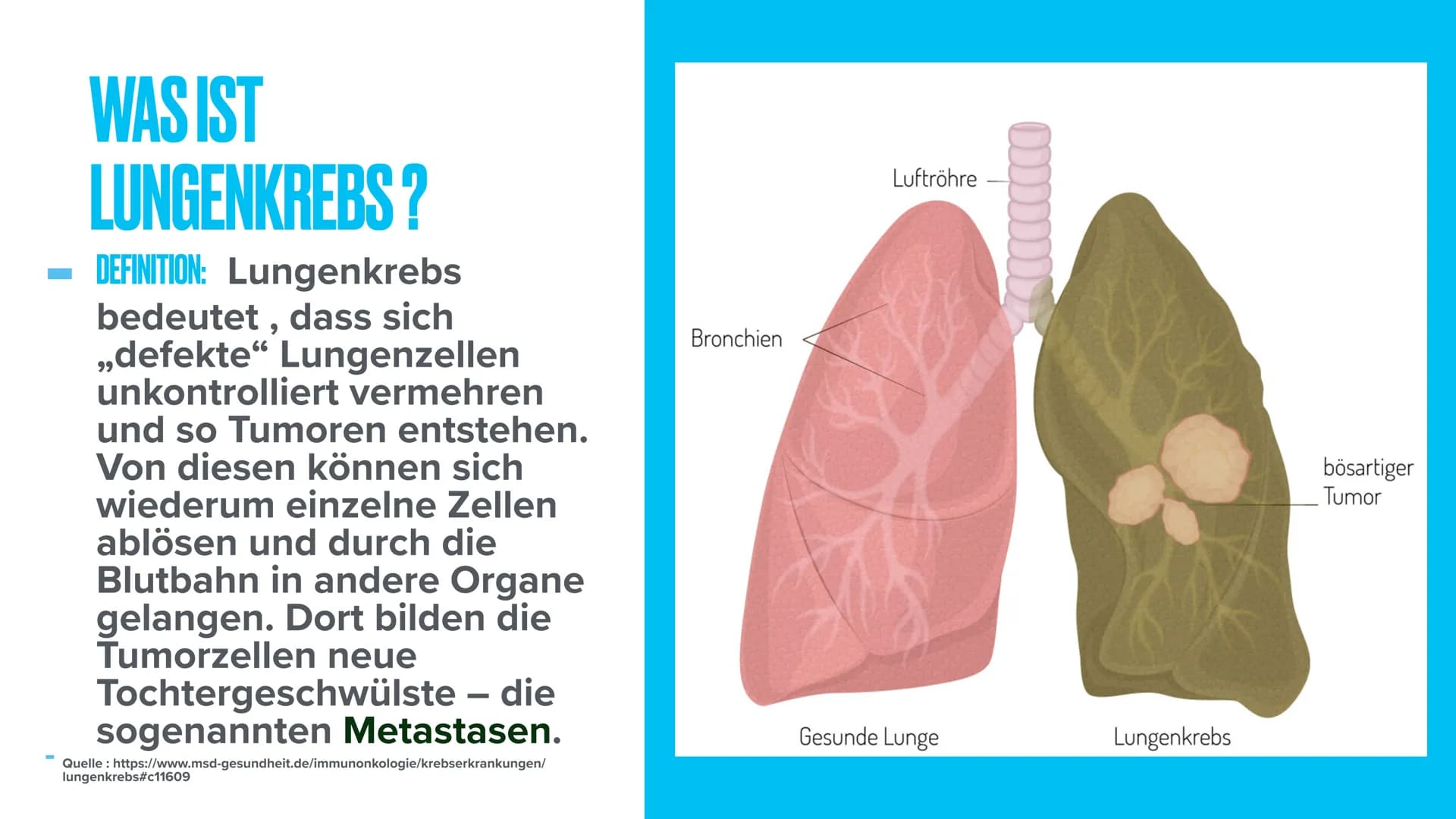 LUNGENKREBS
Biologie THEMEN
- Was ist Lungenkrebs?
Erkrankte & verstorbene in Deutschland
- Arten von Lungenkrebs
- Stadien von Lungenkrebs
