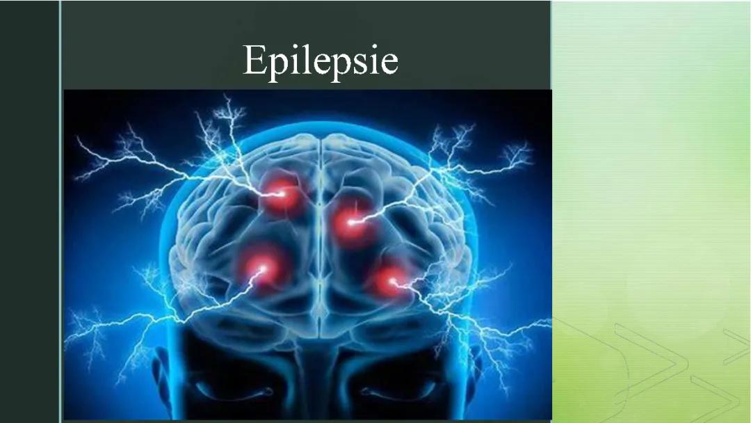 Epilepsie 