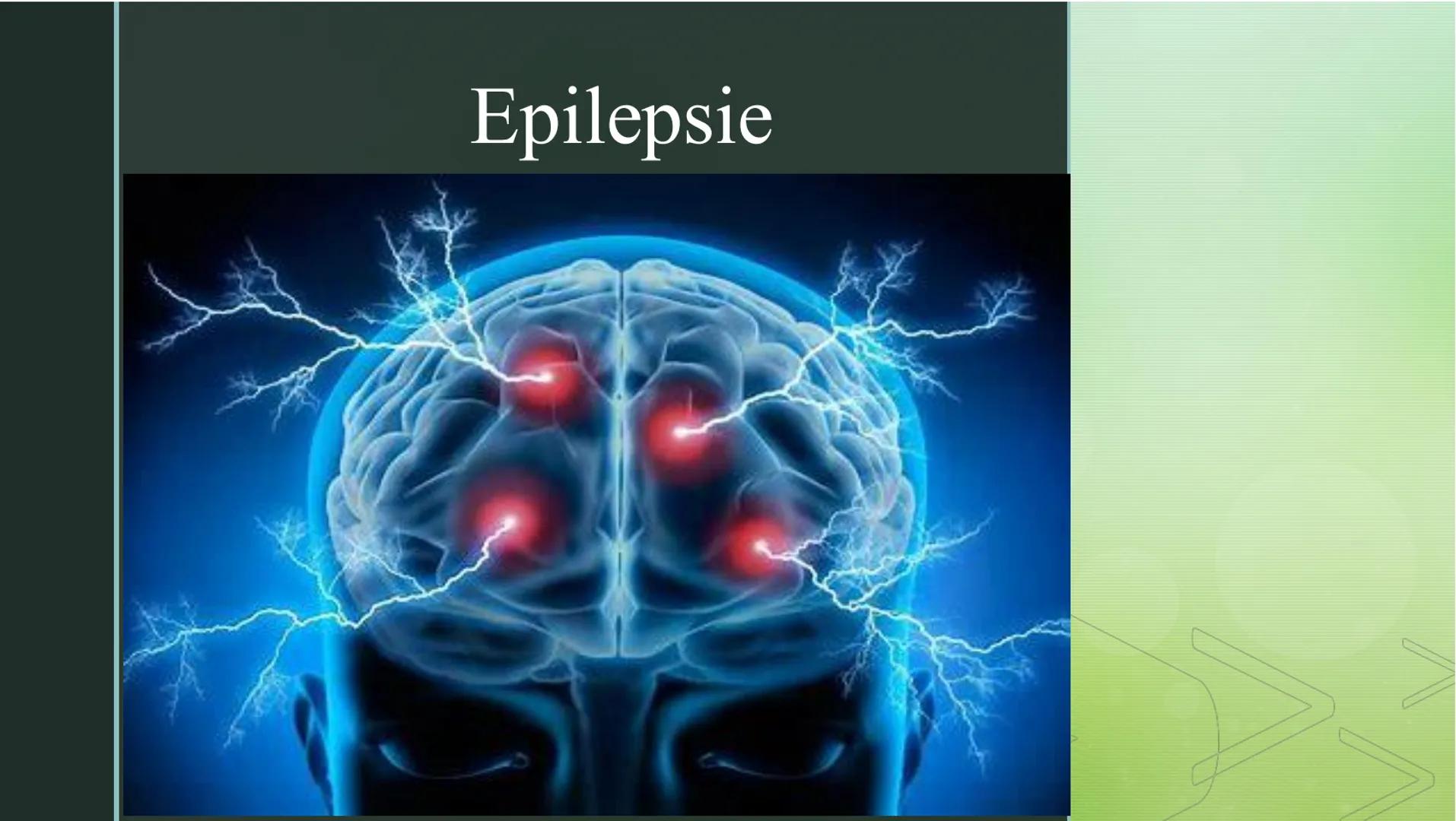 Epilepsie ➤ Was ist Epilepsie?
➤ Ursachen
Inhaltsverzeichnis
➤ Arten und Phasen
> Symptome
Unterschiede zwischen Epilepsie und epileptischer
