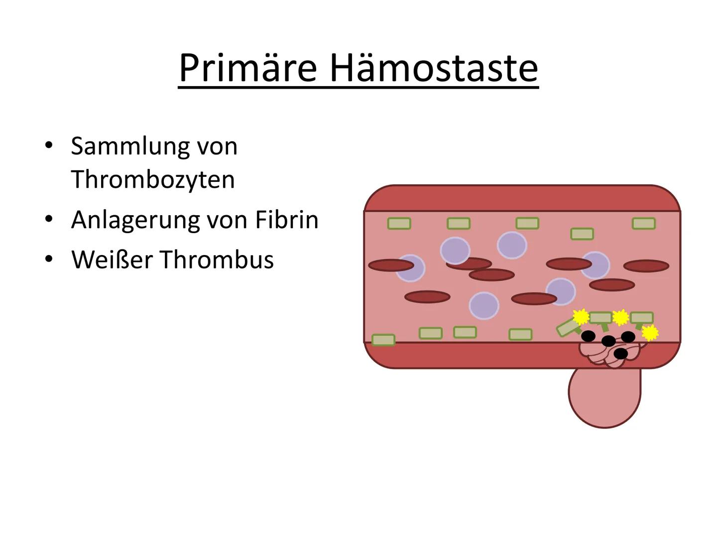 # Hämostase # Inhaltsverzeichnis

*   Was ist Hämostase?
*   Primäre Hämostase
    *   Thrombozytenaggregation
*   Sekundäre Hämostase
    *