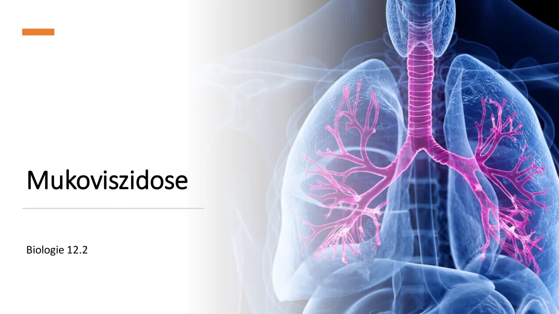Mukoviszidose
Biologie 12.2 Inhalt
●
●
Ursachen
• Genetische Vererbung
• Betroffene Organe und Anzeichen einer
Erkrankung
Diagnostik
●
Allge