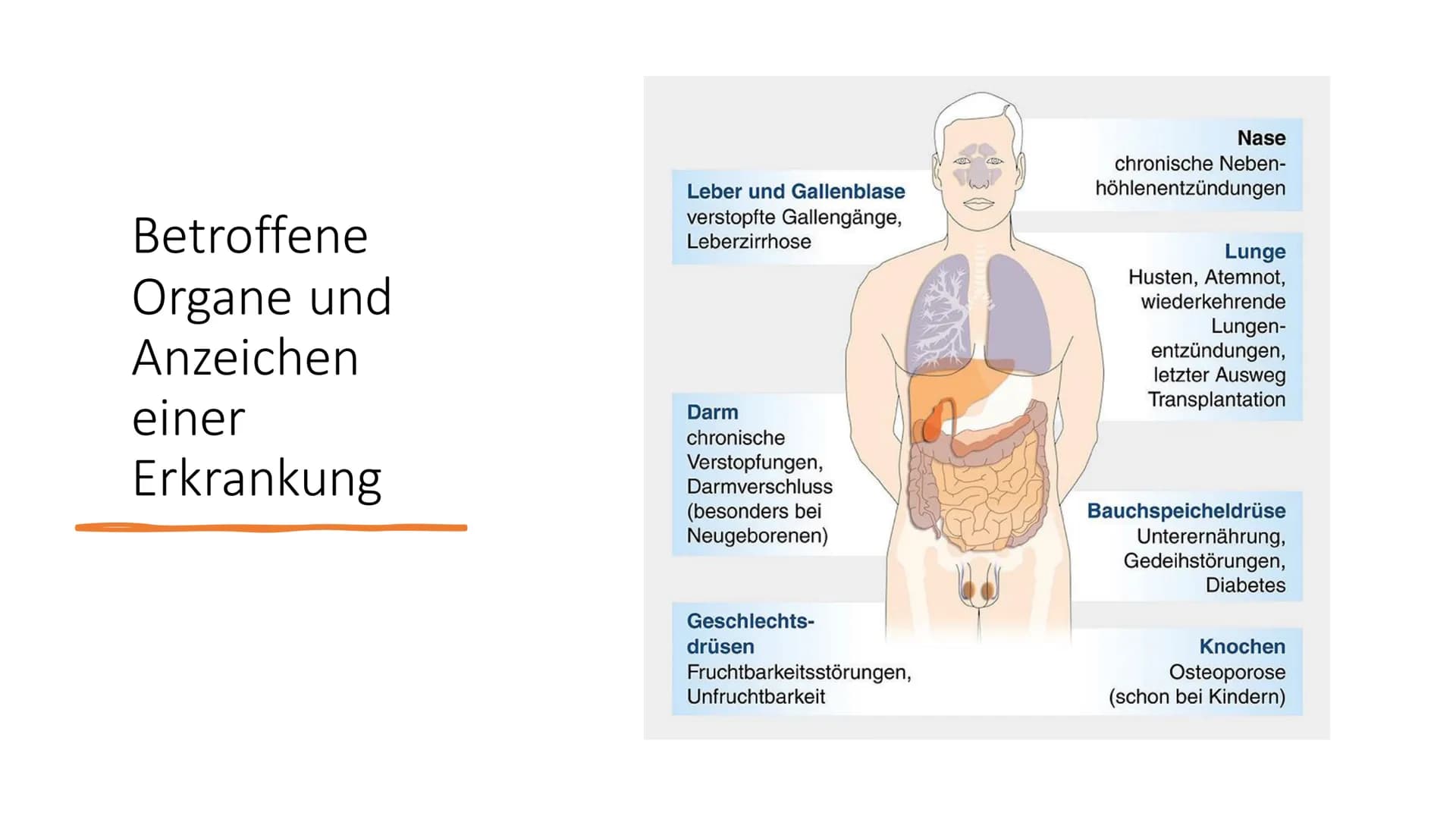 Mukoviszidose
Biologie 12.2 Inhalt
●
●
Ursachen
• Genetische Vererbung
• Betroffene Organe und Anzeichen einer
Erkrankung
Diagnostik
●
Allge