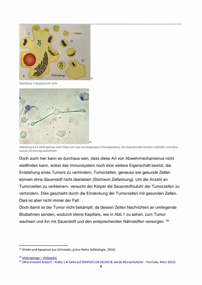 WIE ENTSTEHT EIGENTLICH
KREBS?
Autor: Luca Dold, KSI
EXPOSEE
Krebs ist keine Erkrankung der Moderne:
Es konnte nachgewiesen werden, dass
Kre