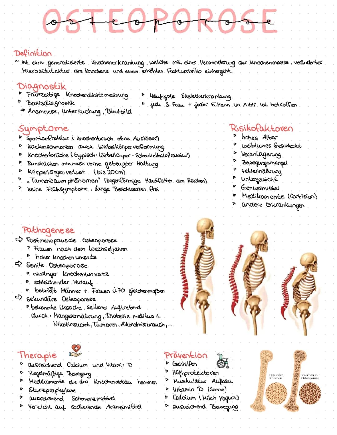 Osteoporose