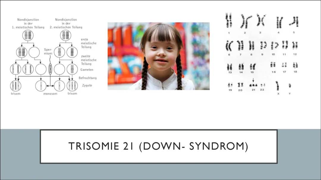 Alles über Trisomie 21: Ursachen, Symptome und Therapie