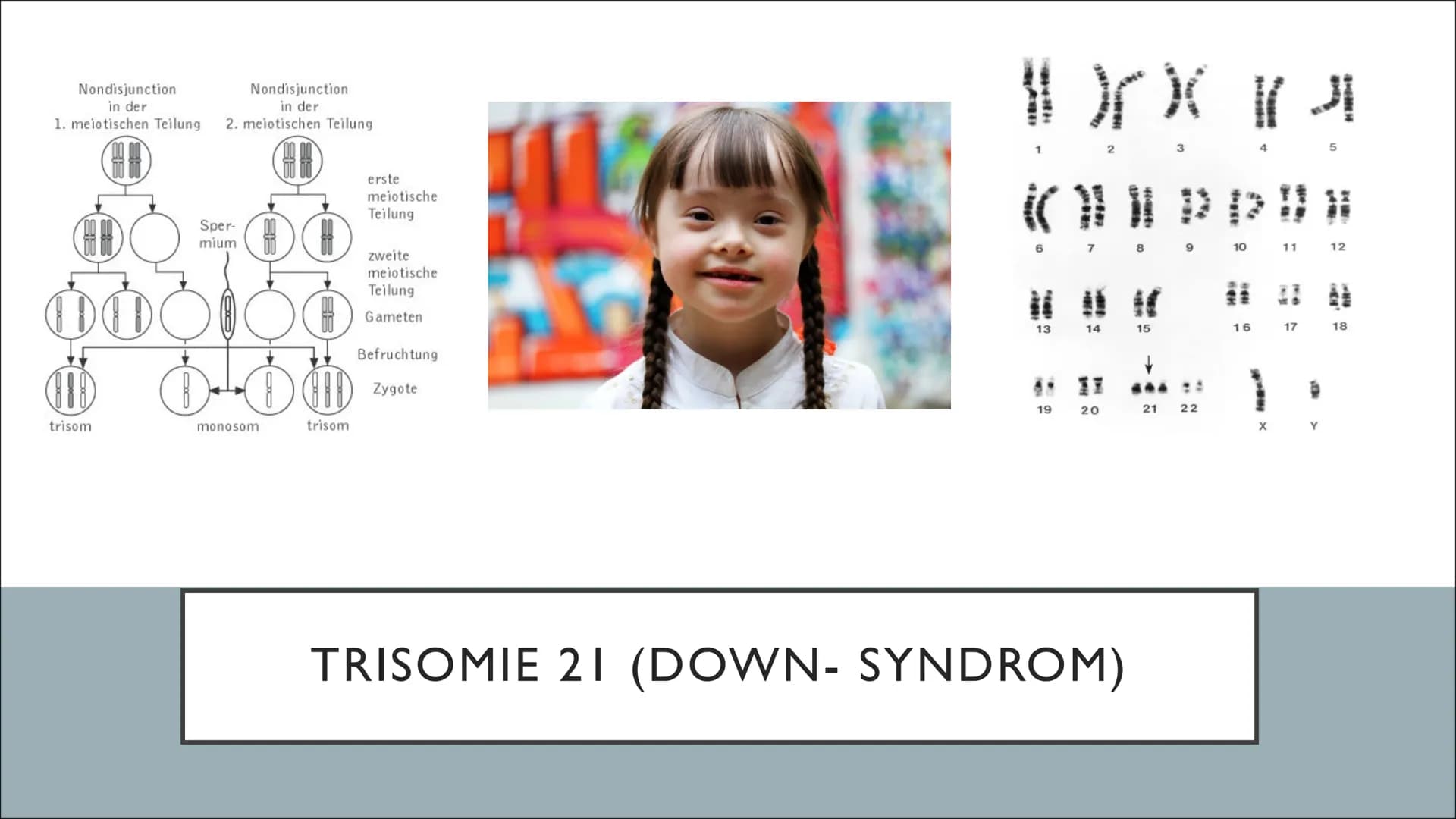 Nondisjunction
Nondisjunction
in der
in der
1. meiotischen Teilung 2. meiotischen Teilung.
Sper-
mium
908)
OO
Ⓡ 0-60
trisom
monosom
trisom
e