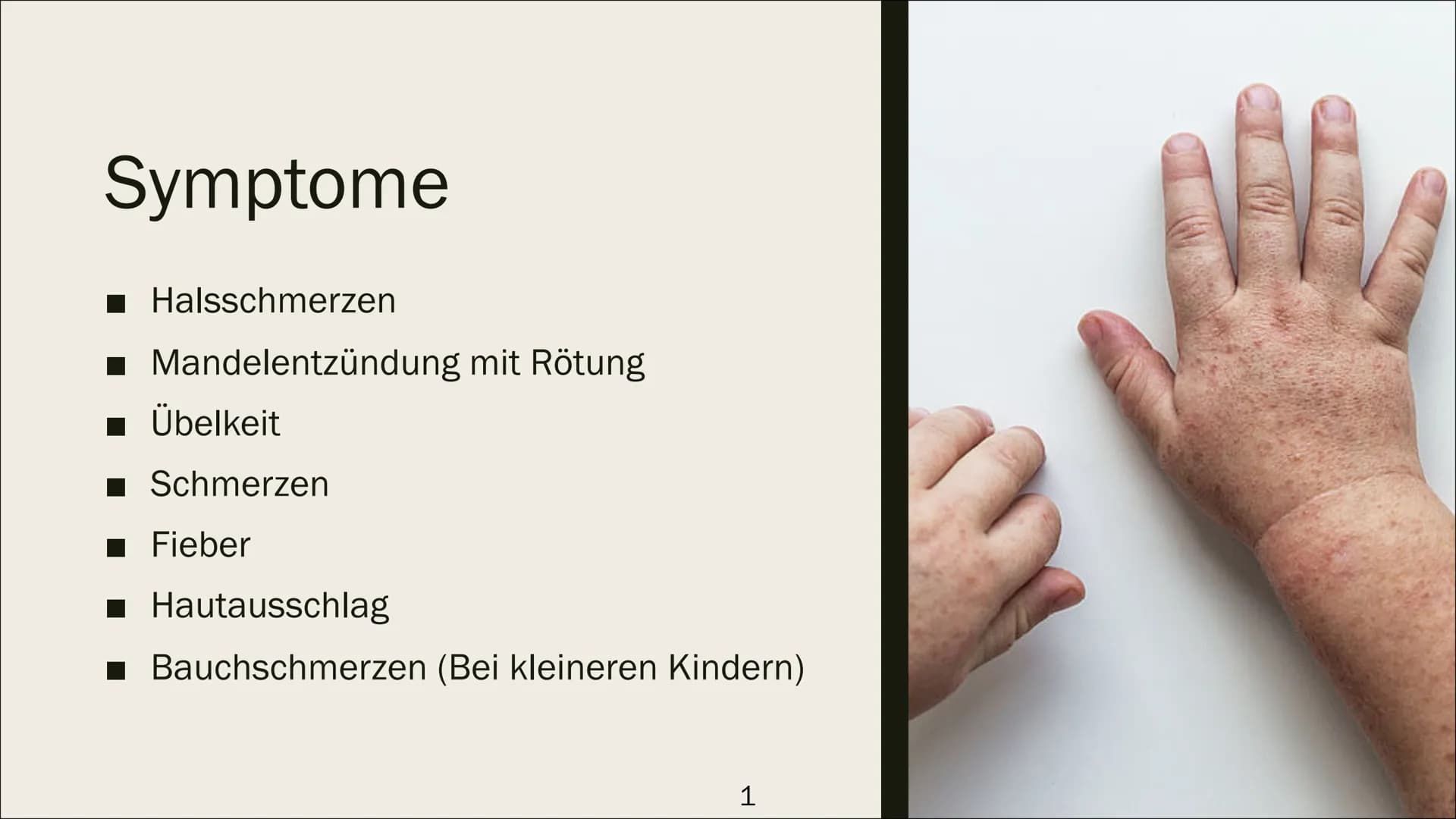 SCHARLACH
~Fahad Al-Omar Inhaltsverzeichnis
■ Seite 1: Symptome
■ Seite 2: Ansteckung
Seite 3: Untersuchung
■ Seite 4: Behandlung
Seite 5: H