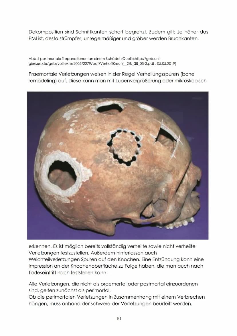 Definition
,,Bei der forensisch-anthropologischen Begutachtung von unbekannten
Knochenfunden ist neben den Fragen nach Geschlecht, Alter, Ze