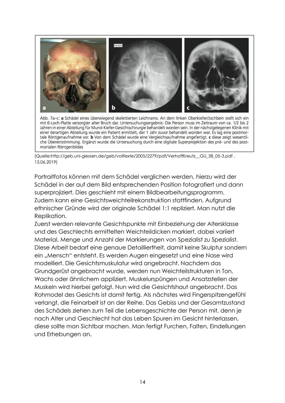 Definition
,,Bei der forensisch-anthropologischen Begutachtung von unbekannten
Knochenfunden ist neben den Fragen nach Geschlecht, Alter, Ze