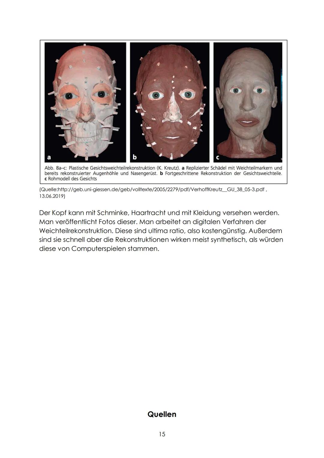 Definition
,,Bei der forensisch-anthropologischen Begutachtung von unbekannten
Knochenfunden ist neben den Fragen nach Geschlecht, Alter, Ze