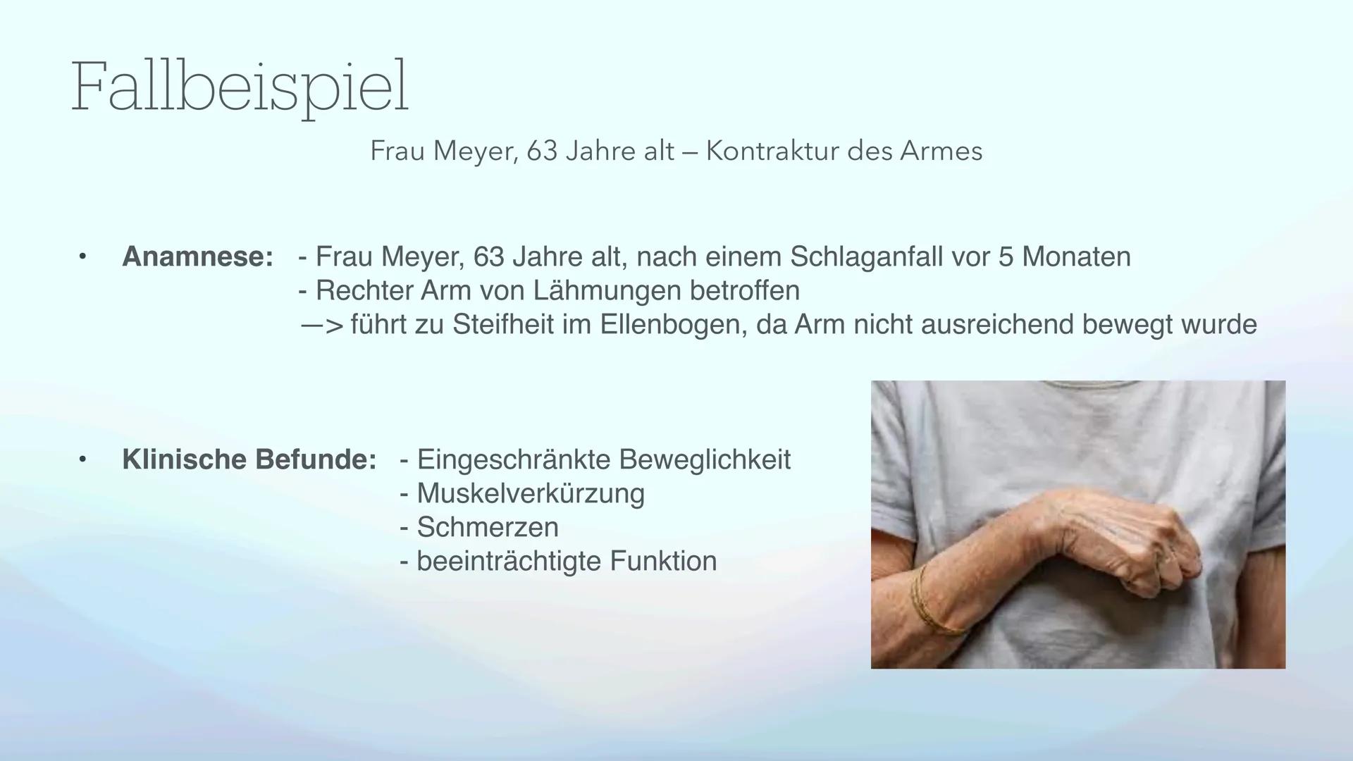 # Kontrakturenprophylaxe
Erkennen, Behandeln und Vorbeugen von Kontrakturen Was fällt euch zum Thema
Kontrakturen ein?
Mentimeter: Inhalts