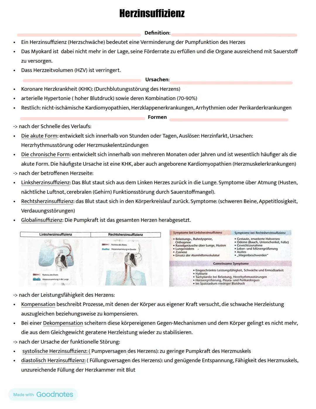 # Herzinsuffizienz
Definition:
- Ein Herzinsuffizienz (Herzschwäche) bedeutet eine Verminderung der Pumpfunktion des Herzes
- Das Myokard i