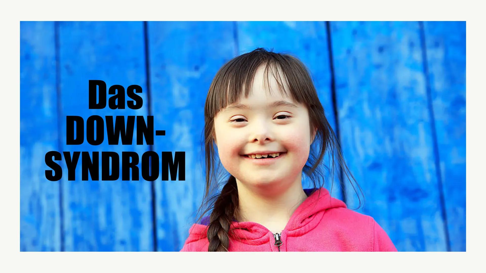 Das
DOWN-
SYNDROM Gliederung
o Was ist das Down-Syndrom?
• Ursache
• Entdeckung
• Formen des Down-Syndroms
。 Diagnosemöglichkeiten
o Krankhe