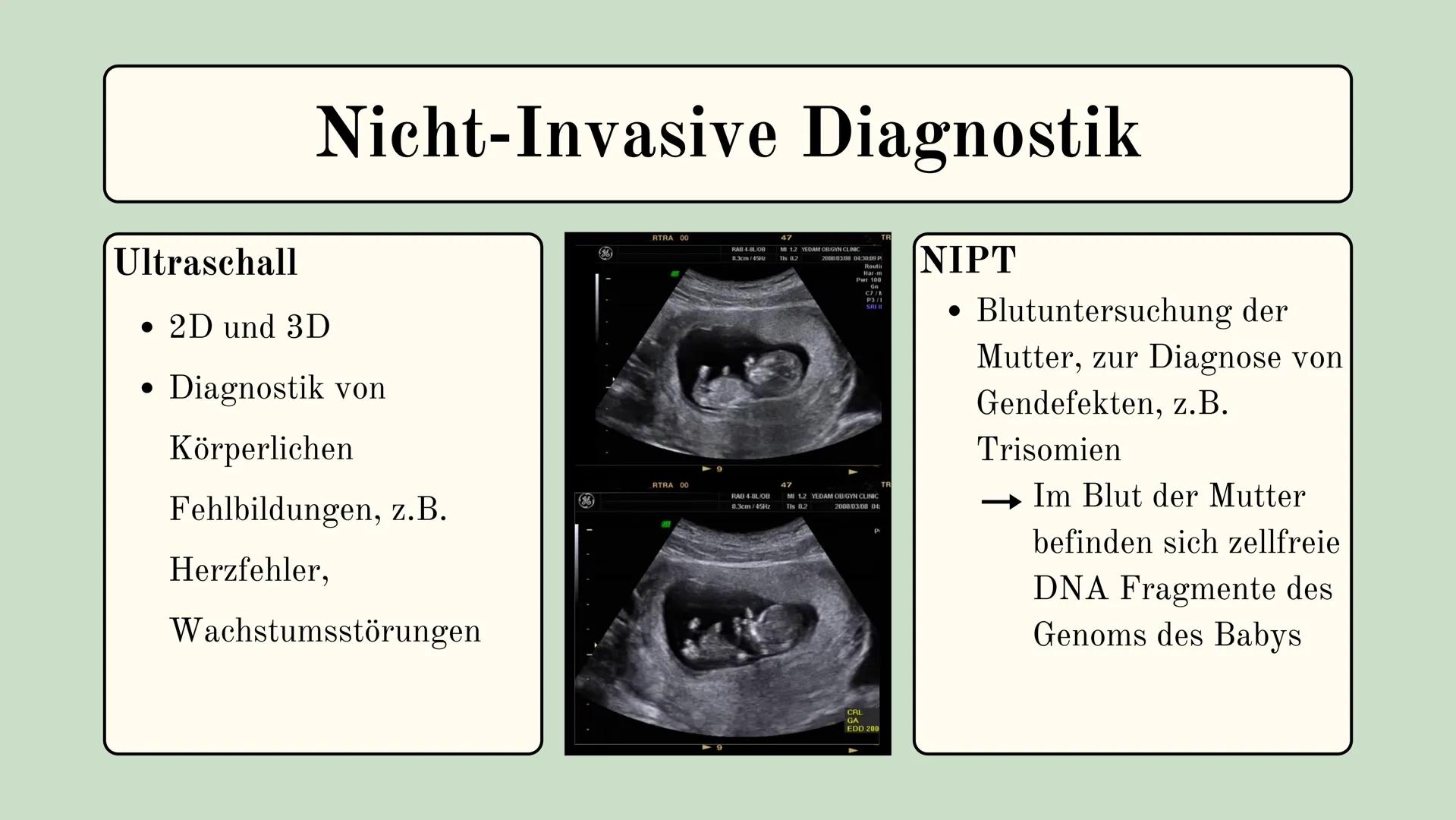 Pränataldiagnostik Spricht die
Pränataldiagnostik Embryos
mit Krankheiten oder
Gendefekten das Recht auf
Leben ab? Inhalt
1. Definition
2. A