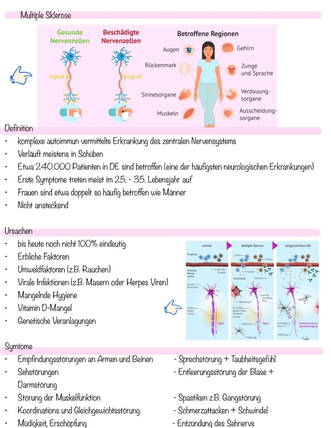 # Multiple Sklerose
Gesunde
Beschädigte
Nervenzellen Nervenzellen
Betroffene Regionen
Augen
Gehirn
Rückenmark
signal
Zunge
und Sprache
