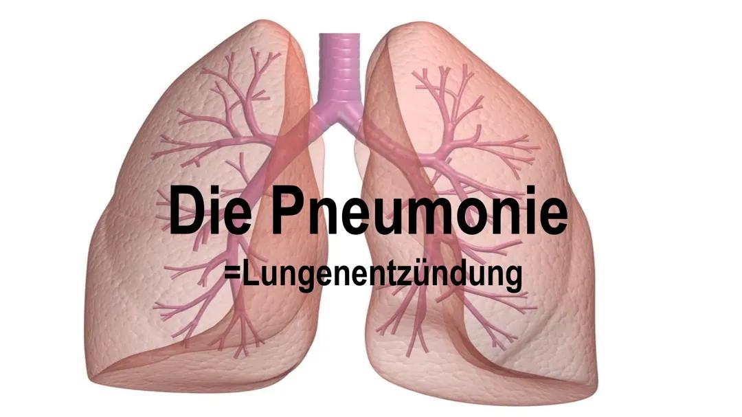 Pneumonie Vortrag
