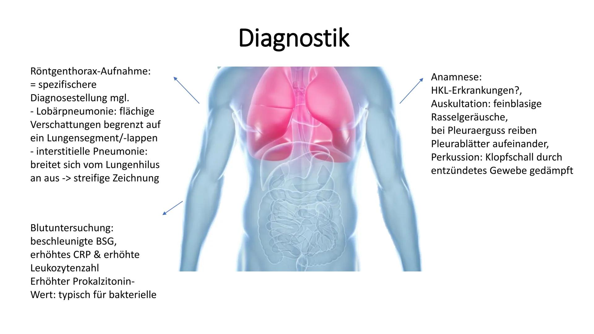 # Die Pneumonie
=Lungenentzündung # Gliederung
1. Was ist eine Pneumonie
2. Risikofaktoren
3. Symptome
4. Formen
5. Therapie & Pflege
6. Ko