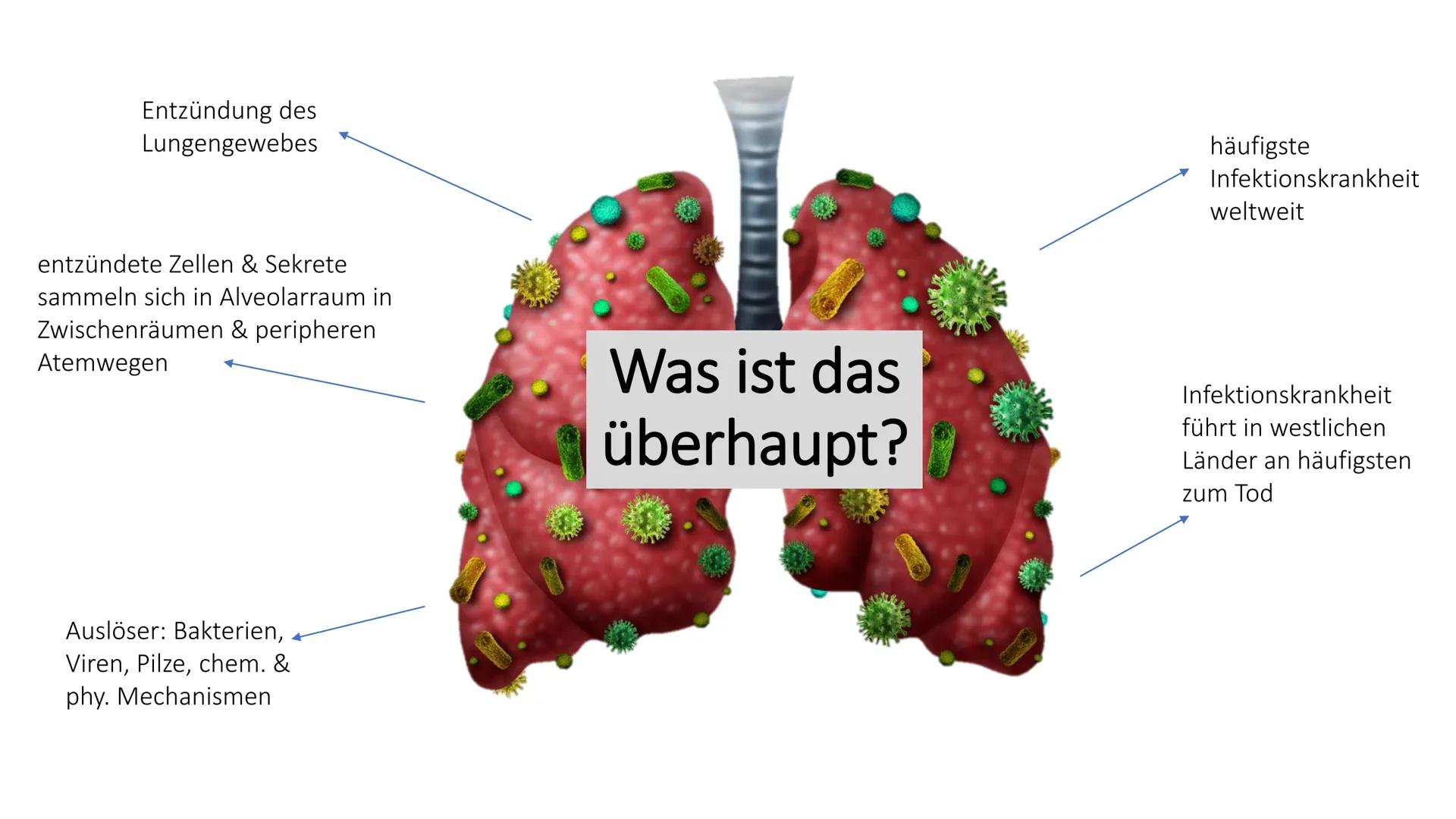 # Die Pneumonie
=Lungenentzündung # Gliederung
1. Was ist eine Pneumonie
2. Risikofaktoren
3. Symptome
4. Formen
5. Therapie & Pflege
6. Ko