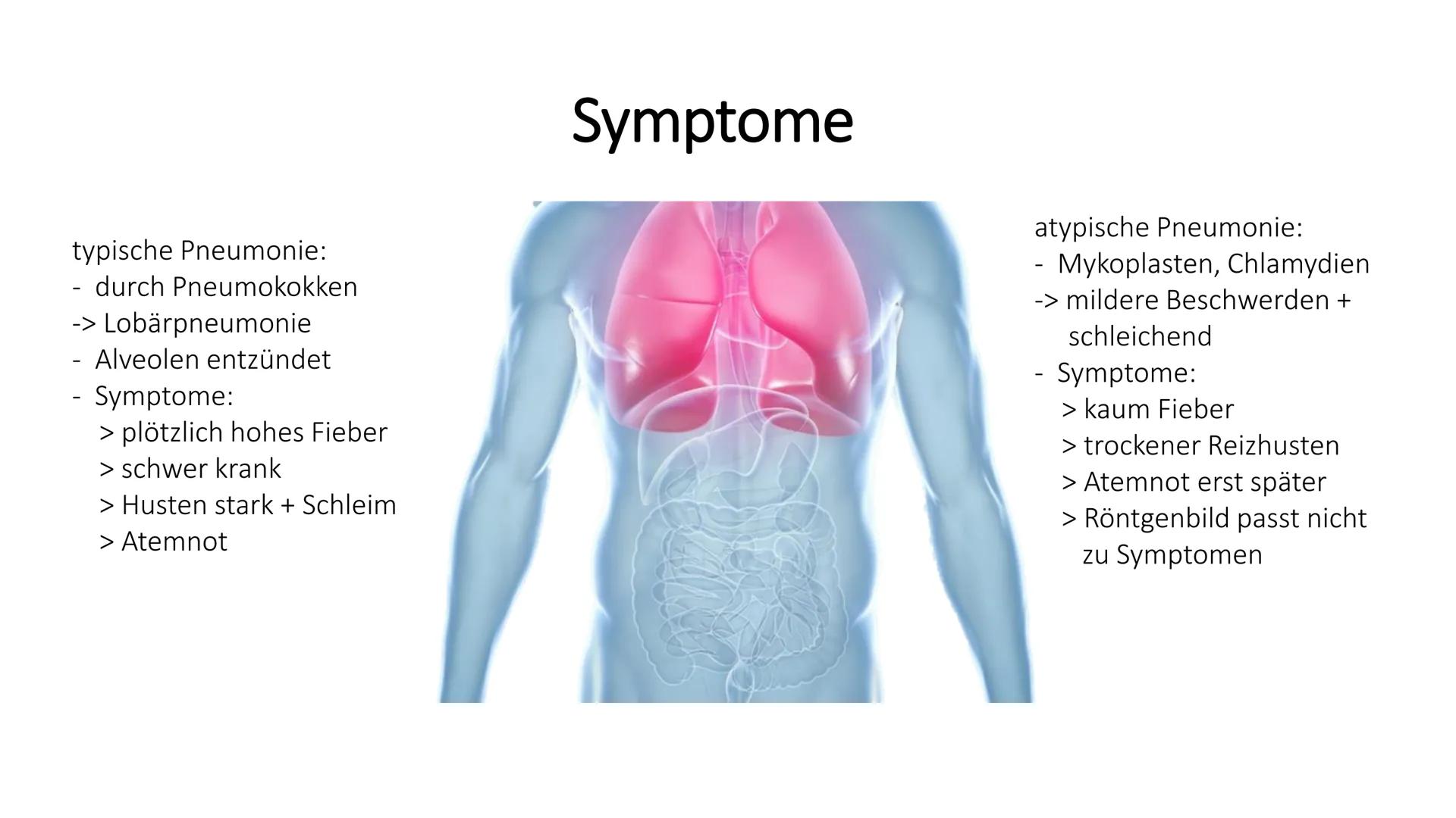 # Die Pneumonie
=Lungenentzündung # Gliederung
1. Was ist eine Pneumonie
2. Risikofaktoren
3. Symptome
4. Formen
5. Therapie & Pflege
6. Ko