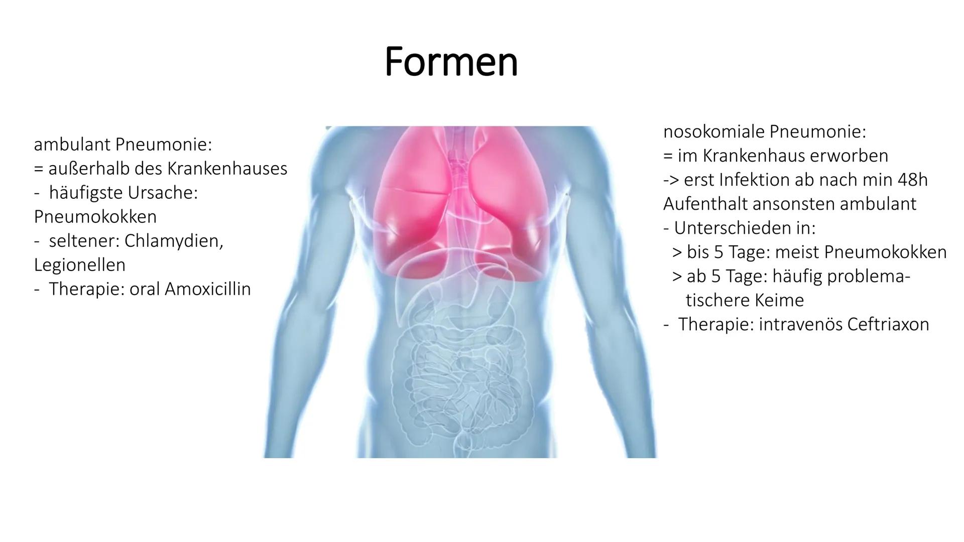 # Die Pneumonie
=Lungenentzündung # Gliederung
1. Was ist eine Pneumonie
2. Risikofaktoren
3. Symptome
4. Formen
5. Therapie & Pflege
6. Ko