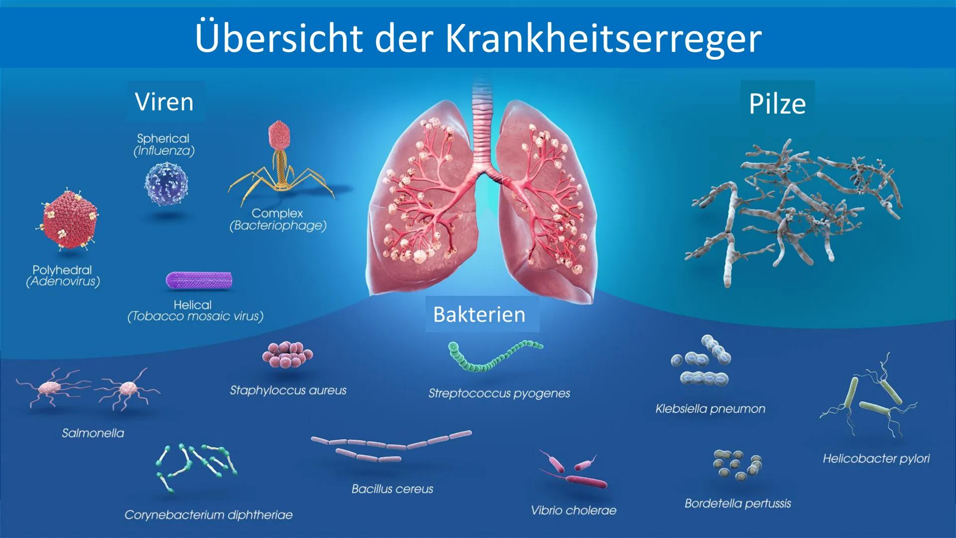 # Die Pneumonie
=Lungenentzündung # Gliederung
1. Was ist eine Pneumonie
2. Risikofaktoren
3. Symptome
4. Formen
5. Therapie & Pflege
6. Ko
