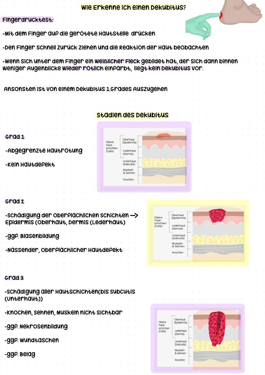 # Dekubitusprophylaxe --- OCR Start ---
Dekubitusprophylaxe
Definition
Ein Dekubitus ist ein Druckgeschwür das durch anhaltenden Druck und/o