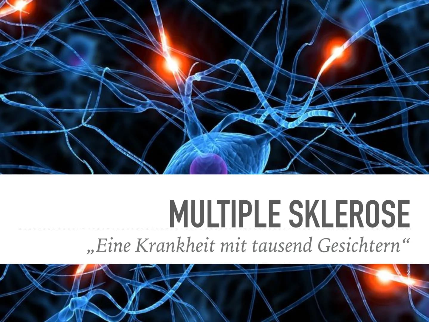 "Multiple Sklerose schläft nie, aber es kann Zeiten geben, in denen die MS weniger aktiv ist" MULTIPLE SKLEROSE
„Eine Krankheit mit tausend