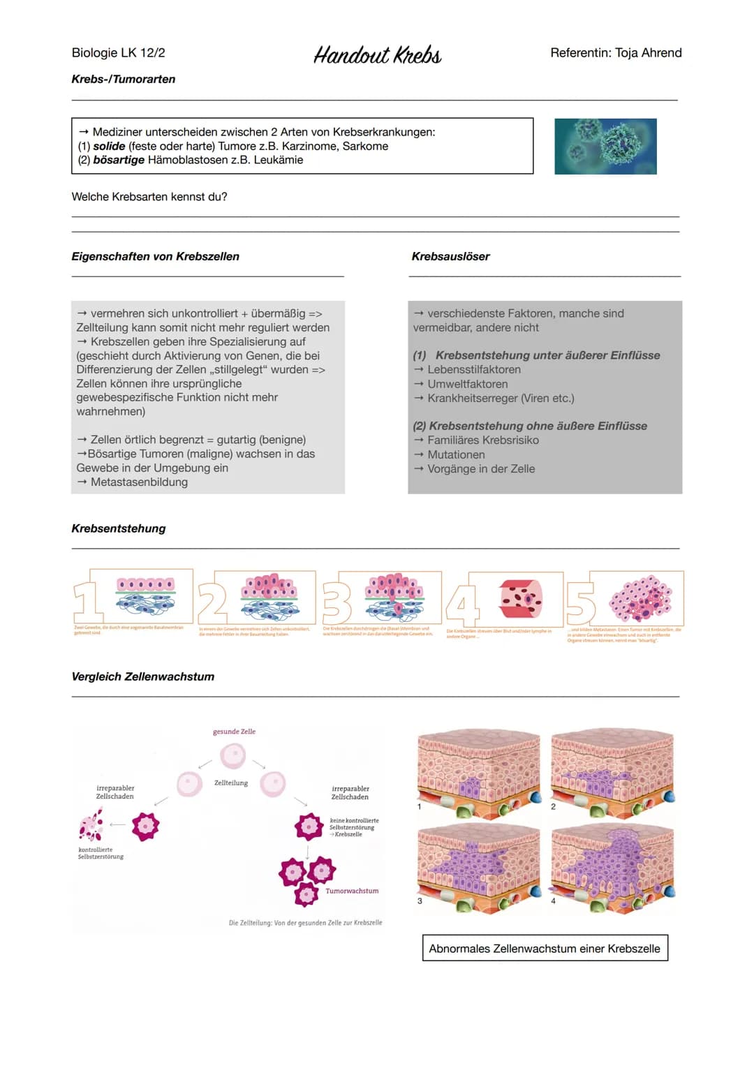 # Biologie LK 12/2
# Handout Krebs
## Definitionen
Referentin: Toja Ahrend
Krebs bezeichnet in der Medizin die unkontrollierte Vermehrung u