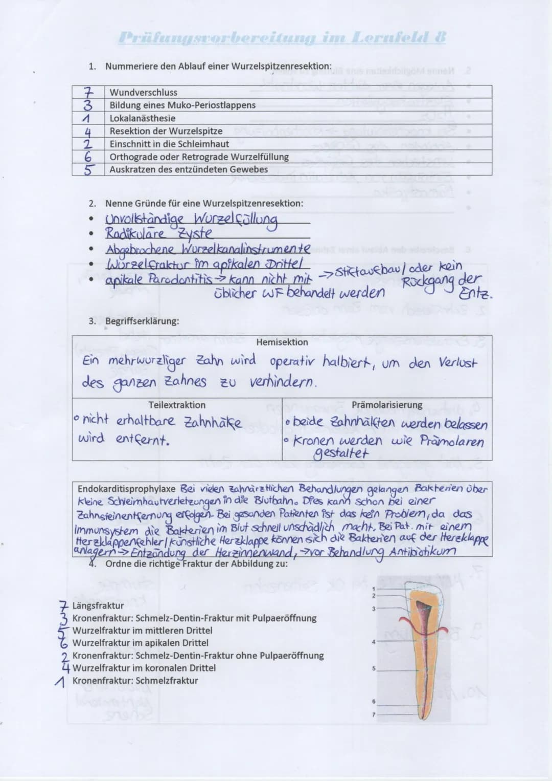 # Prüfungsvorbereitung im Lernfeld 8
## 1. Nummeriere den Ablauf einer Wurzelspitzenresektion:
7. Wundverschluss
3. Bildung eines Muko-Peri