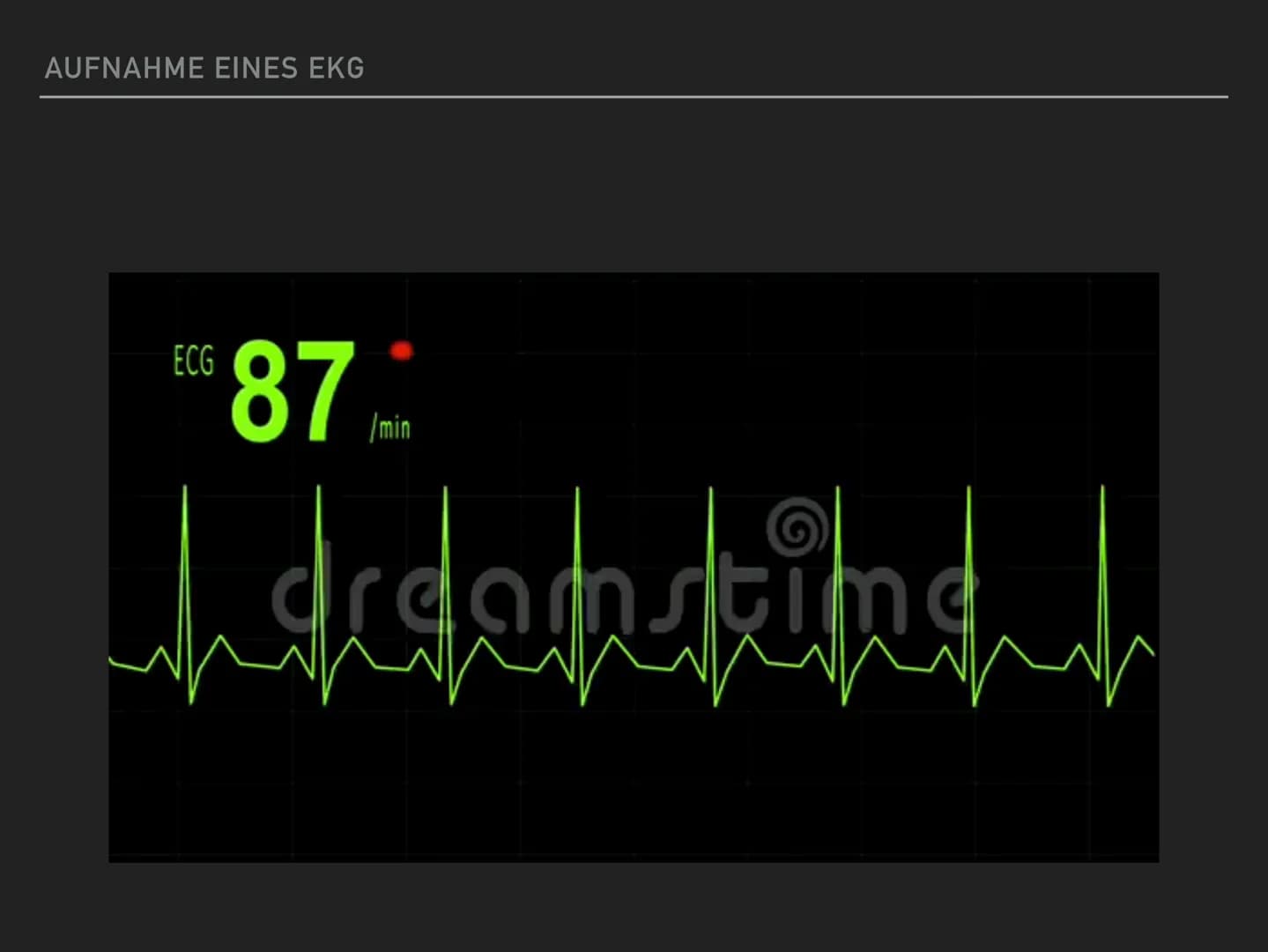 # EEG & Ekg
## EKG (Elektrokardiogramm):
= Aufzeichnung von elektrischen Spannungen bei jedem Herzschlag
### Gründe für ein EKG:
- Herzinf
